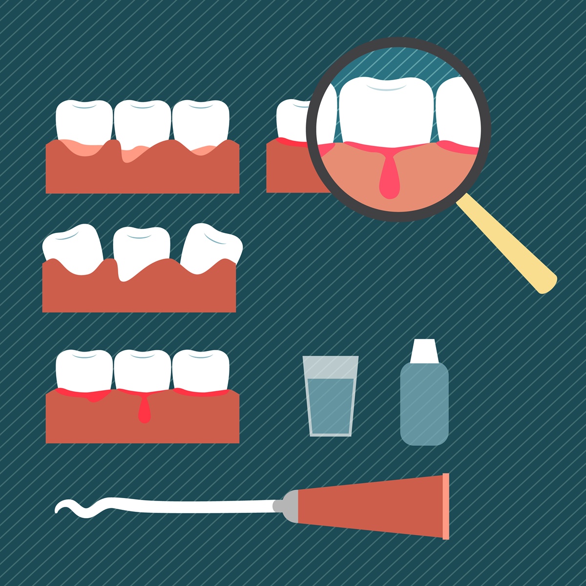 Santé des dents : gare à la parodontite!