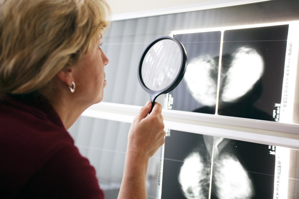 Cancer du sein : la mammographie de dépistage, c’est toute l’année