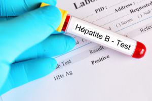 test pour l'hépatite b