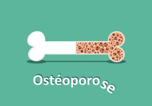 l'ostéoporose