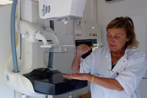 mammographie de dépistage