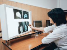 mammographie de dépistage