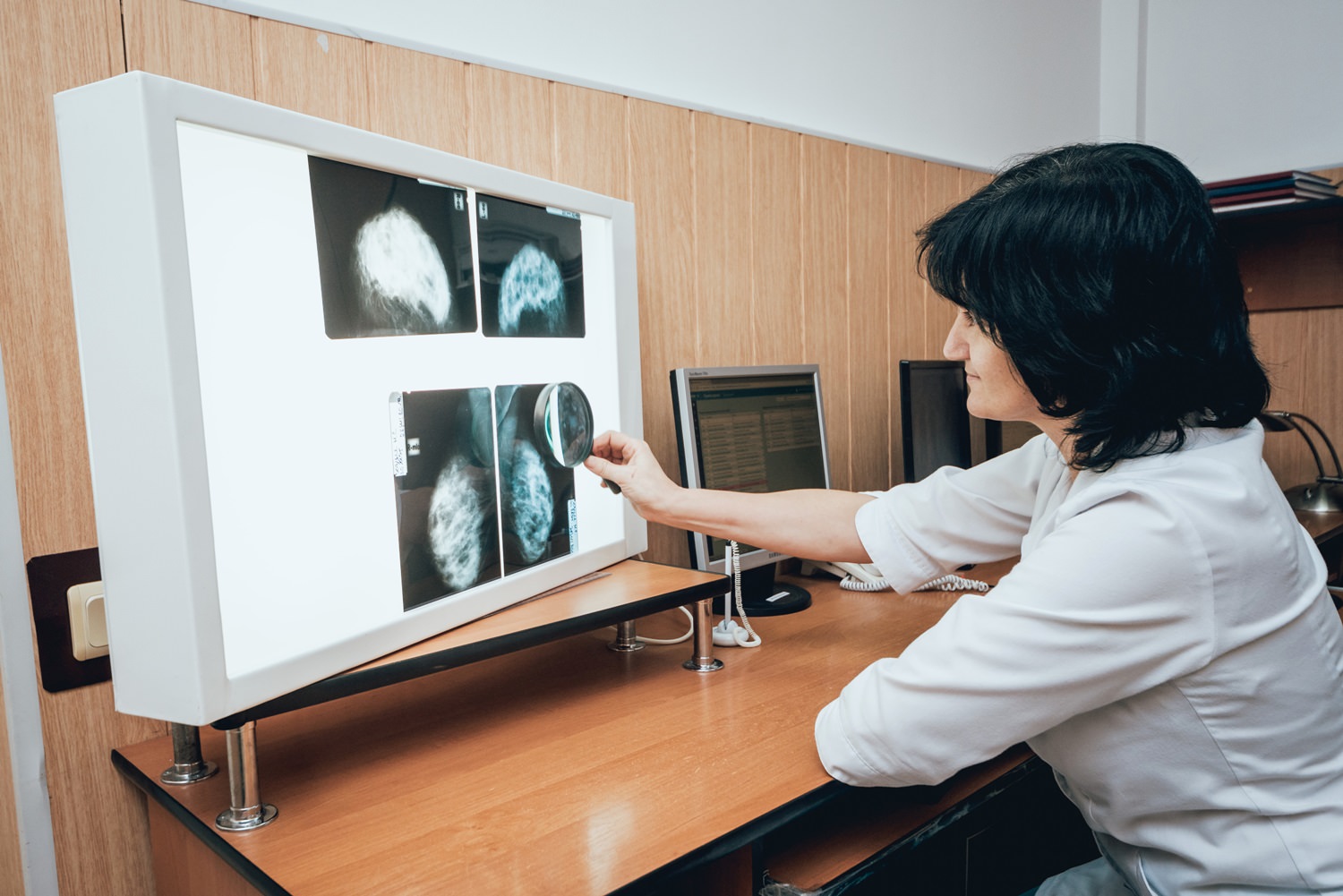 La mammographie de dépistage : deux avis valent mieux qu’un !