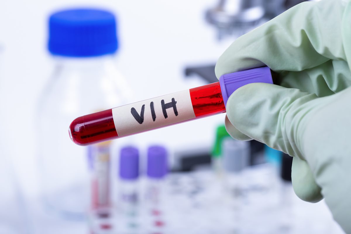 Faire le test de dépistage du VIH | santé pratique Paris